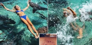 Instagram model će svoje poziranje sa ajkulama upamtiti po ugrizu napad ajkule instagram