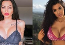 Plastične operacije imaju i svoje loše strane od zdravstvenih do psihičkih Plastične operacije isu tako cool