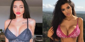 Plastične operacije imaju i svoje loše strane od zdravstvenih do psihičkih Plastične operacije isu tako cool