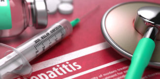Hepatitis – Najčešće oboljenje kod osoba koje zloupotrebljavaju narkotike Hepatitis