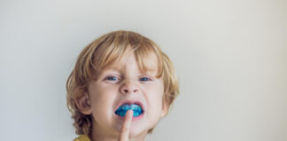 Šta je Myobrace sistem? Myobrace